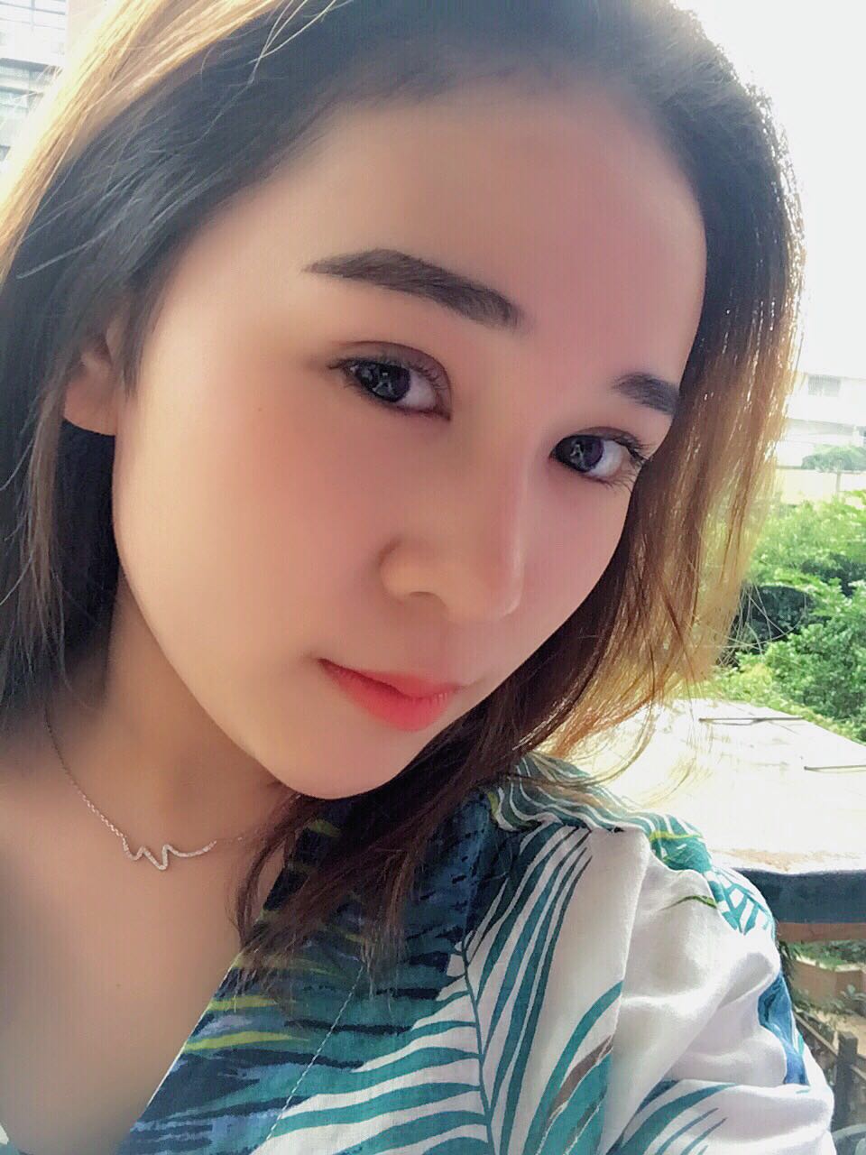 蚌埠韓美美萊整形醫(yī)生鄭捷做開眼角怎么樣？附案例效果圖