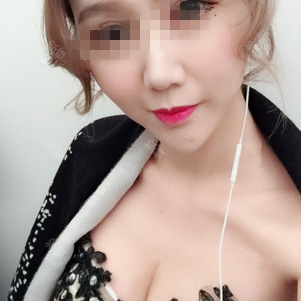 保定杏林中醫(yī)醫(yī)院整形外科醫(yī)生從相文做自體脂肪隆胸效果怎么樣？附隆胸案例
