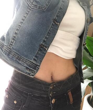 保定現(xiàn)代女子醫(yī)院整形美容中心做腰腹部吸脂怎么樣？附林秀蓮醫(yī)生案例效果圖