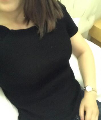 保定現(xiàn)代女子醫(yī)院整形美容中心做腰腹部吸脂怎么樣？附林秀蓮醫(yī)生案例效果圖
