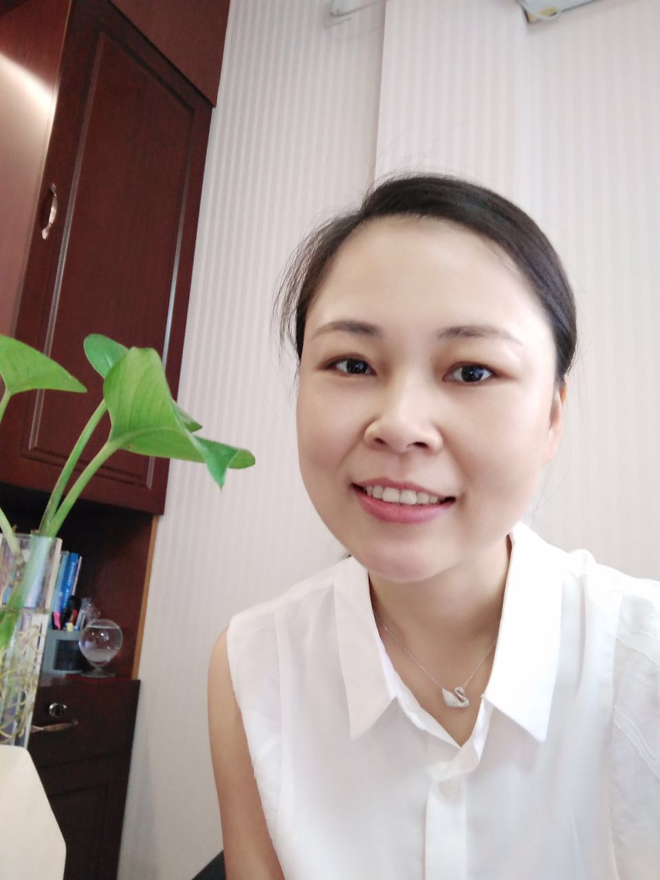 保定東陽(yáng)口腔醫(yī)院趙星醫(yī)生做牙齒瓷貼面怎么樣?附牙齒瓷貼面案例效果對(duì)比圖