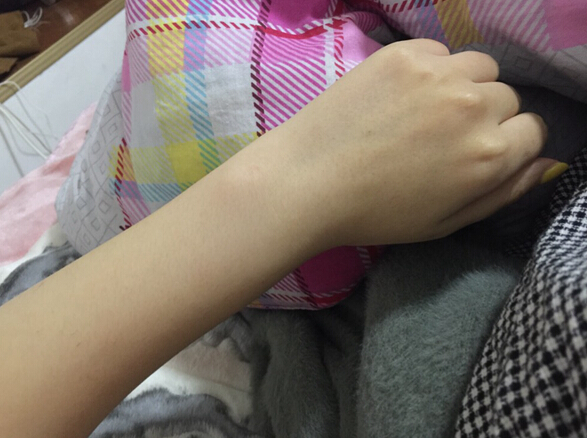 蚌埠市第三人民醫(yī)院燒傷整形科李方奇注射美白針效果怎么樣？安全嗎？附案例