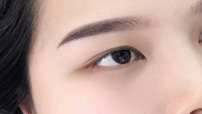 開眼角一般需要多少錢？
