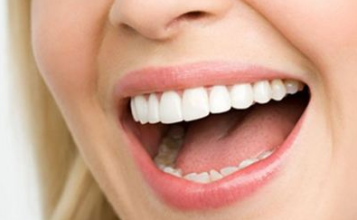 皓齒美白的價(jià)格一般是多少？手術(shù)價(jià)錢貴不貴？