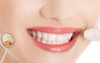 合金烤瓷牙多少錢一個(gè)？?jī)r(jià)錢貴不貴？