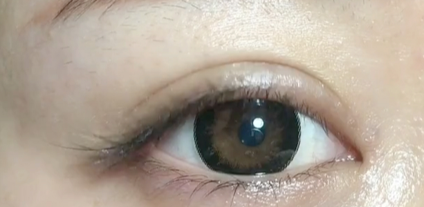 全切雙眼皮好看嗎？