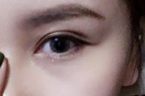 做雙眼皮對(duì)眼睛視力有影響嗎？雙眼皮對(duì)身體有沒(méi)有危害？