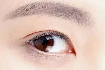 開內(nèi)眼角大概多少錢？開內(nèi)眼角大概需要多久恢復(fù)？