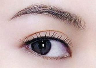 開內(nèi)眼角的恢復(fù)期是多久？