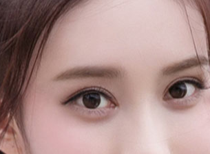 開眼角一般需要多少錢？