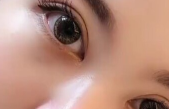 開眼角有沒有風(fēng)險？