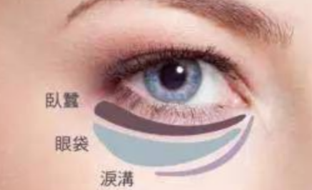 激光能祛除眼袋嗎？
