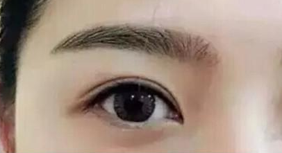 廣州眼部整形哪里好？這幾家醫(yī)院真不錯！