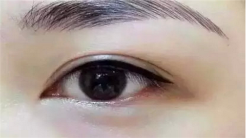 長沙開眼角整形醫(yī)院哪里好？這10家醫(yī)院真不錯！