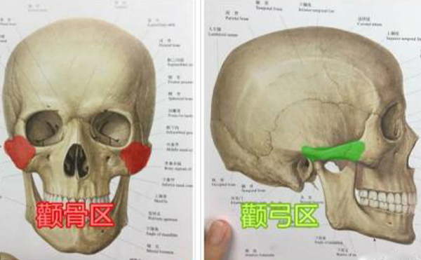 顴骨整形手術(shù)多久能消腫？