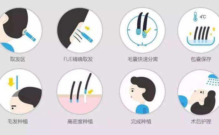 體毛種植的方法有哪些？
