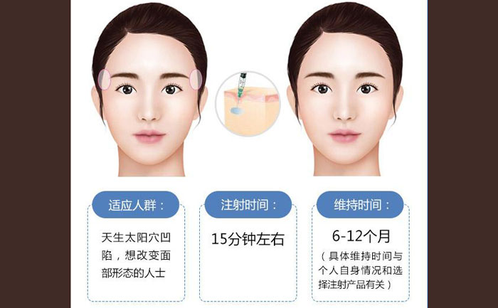 玻尿酸豐太陽(yáng)穴一般幾支？