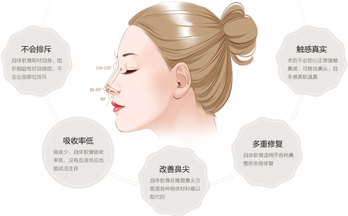 自體軟骨隆鼻可以永久的嗎？