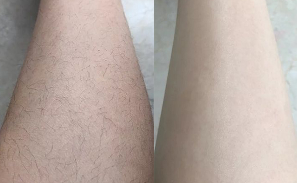 冰點脫腿毛效果怎么樣？