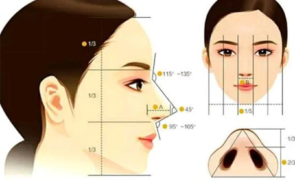 假體隆鼻恢復(fù)期要多長時間？假體隆鼻不滿意還能做注射隆鼻改善嗎？