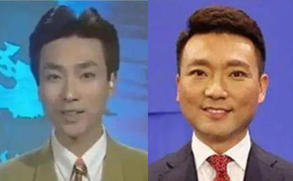 治療咬肌肥大的方法有哪些？