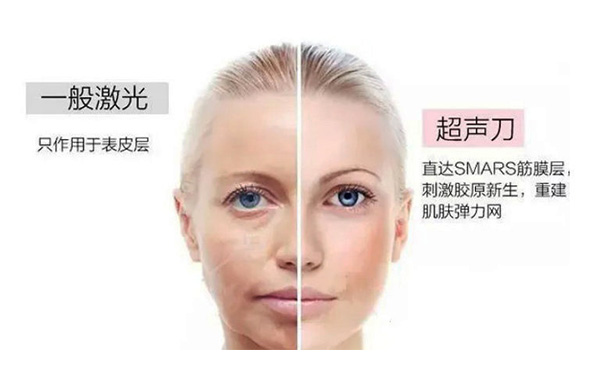 超聲刀有什么優(yōu)勢(shì)？