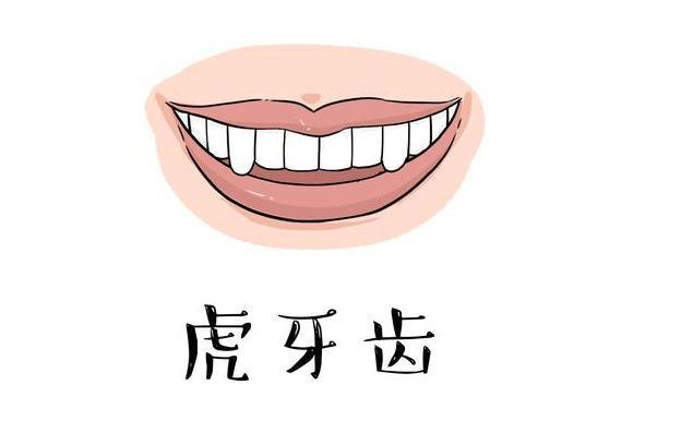 虎牙矯正需要多久？