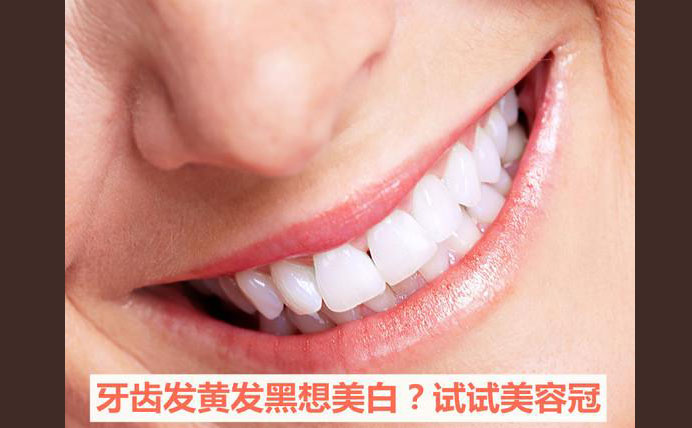 牙齒美容冠大約多少錢？牙齒美容冠怎么做的？