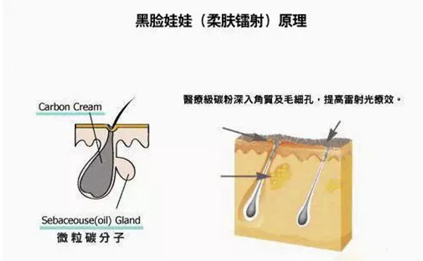 黑臉娃娃是什么？
