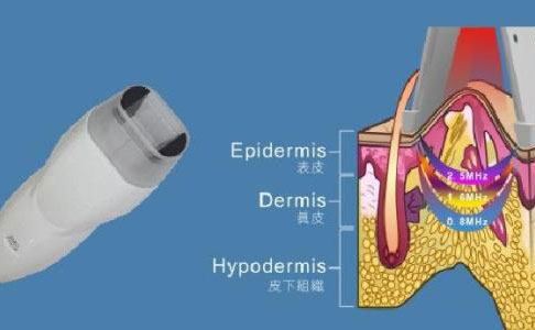 射頻除皺的效果好嗎？