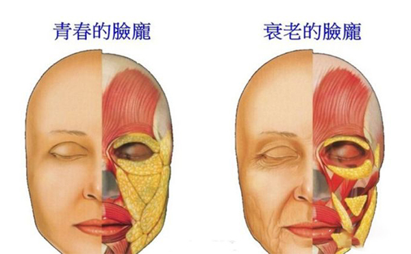 電波拉皮的誤區(qū)？