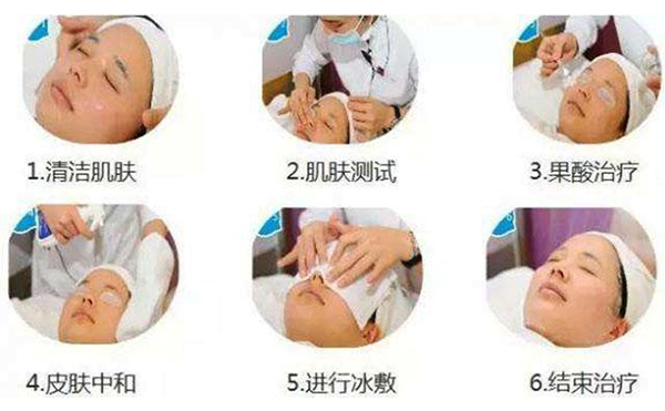 果酸煥膚的過(guò)程是什么？