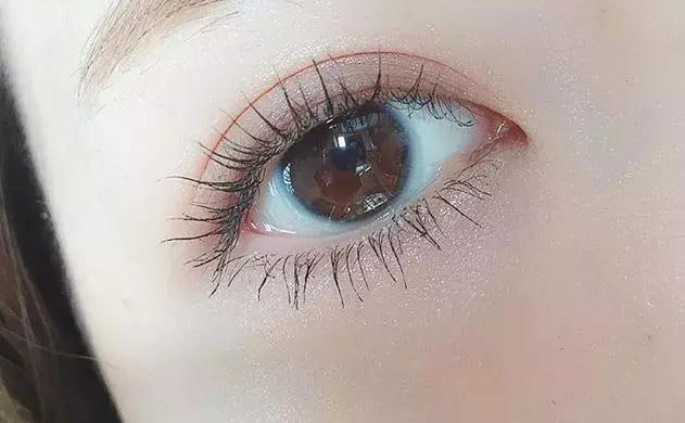 激光雙眼皮手術(shù)多少錢？激光雙眼皮手術(shù)需要多久恢復(fù)時間？