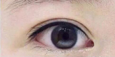 半永久睫毛線術后