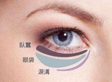 眼袋失敗修復(fù)要怎么處理？切眼袋需要多長時間恢復(fù)？
