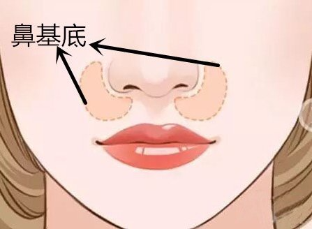 做玻尿酸墊鼻基底風(fēng)險有哪些？深圳市玻尿酸豐鼻基底大概需要費(fèi)用？