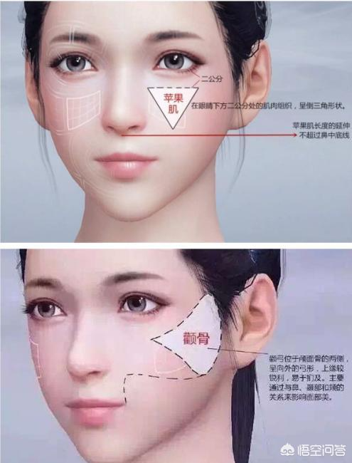 玻尿酸填充蘋(píng)果肌后效果能保持多久？想豐蘋(píng)果肌是自體好一點(diǎn)還是玻尿酸好一點(diǎn)？