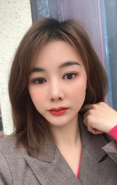 廈門(mén)華美名媛整形美容醫(yī)院做雙眼皮手術(shù)的最終效果