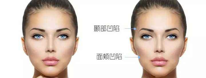 熱瑪吉做一次可以保持多久？熱瑪吉的原理和功效