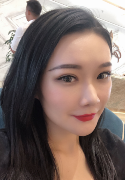  寧波尚美整形美容醫(yī)院做雙眼皮手術后的效果