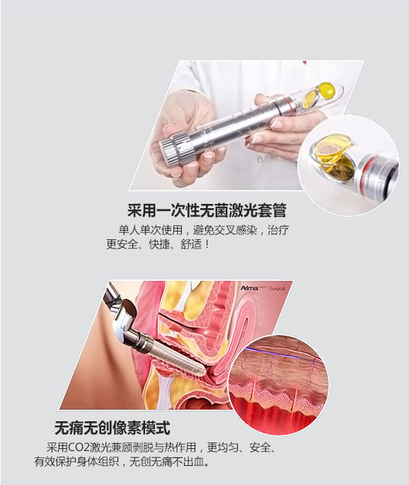 成都愛爾麗整形激光緊縮陰道怎么樣？激光緊縮陰道注意什么？