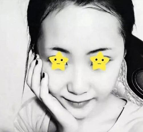 做綜合鼻，上海首爾麗格安建榮鼻綜合真人案例照片