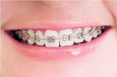 常州瀚景口腔牙齒拋光怎么樣？牙齒拋光有什么作用？