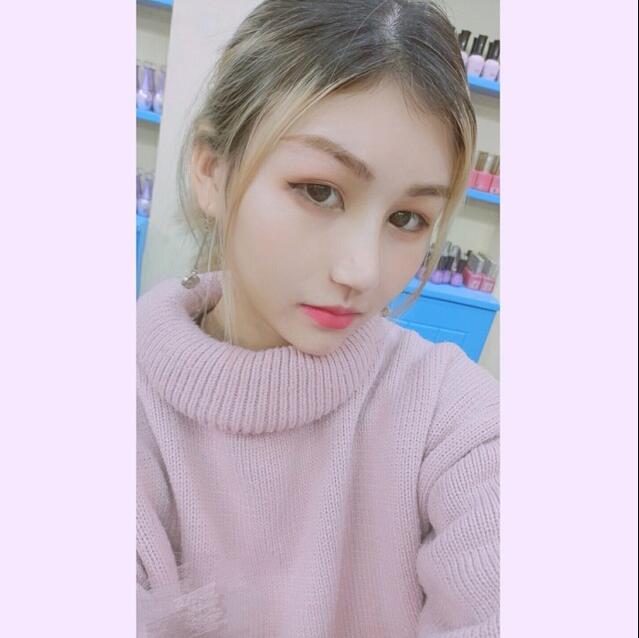成都蜀尚蓉雅美容整形醫(yī)院做鼻綜合術后15天的情形