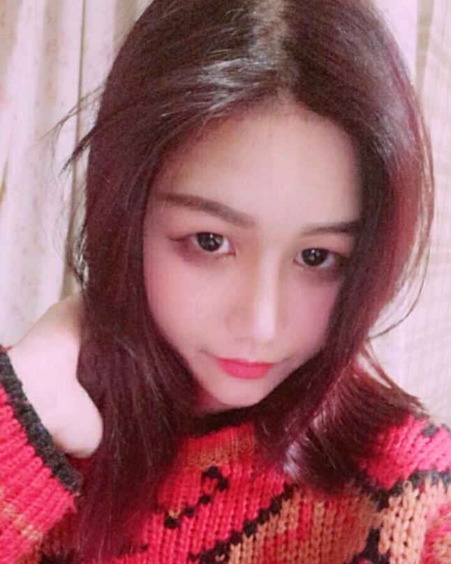 成都蜀尚蓉雅美容整形醫(yī)院做鼻綜合術后的鼻子美美的